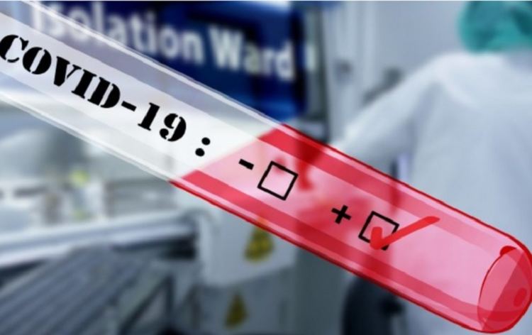 Пет позитивни проби на ковид-19 на 26 юни в Смолян