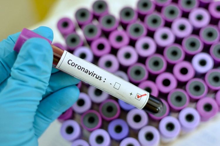181 заразени с COVID-19 в Асеновград от началото на пандемията до днес