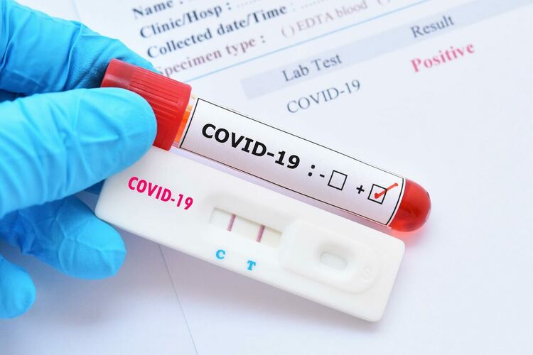 Учените разбраха защо някои пациенти губят обоняние или вкус при COVID-19